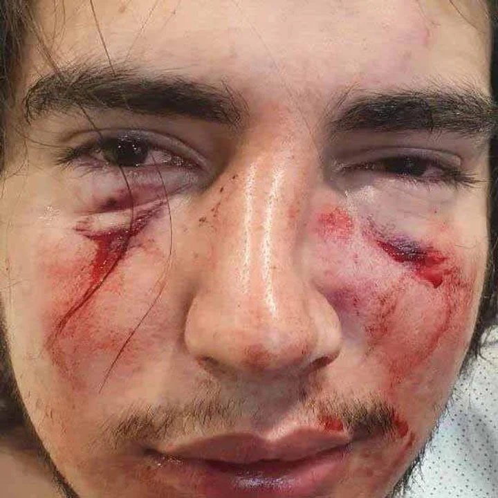 Un grupo de rugbiers golpeó y desfiguró a un joven en Córdoba