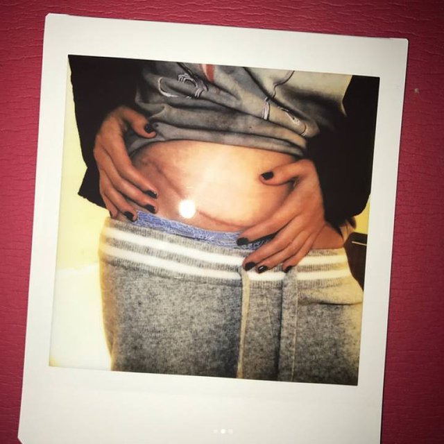 La mejor amiga de Selena Gómez le donó un riñón