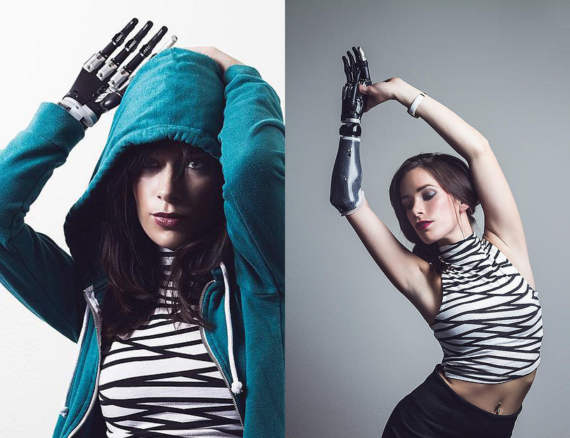 La primera modelo con un brazo biónico desfilará en Nueva York